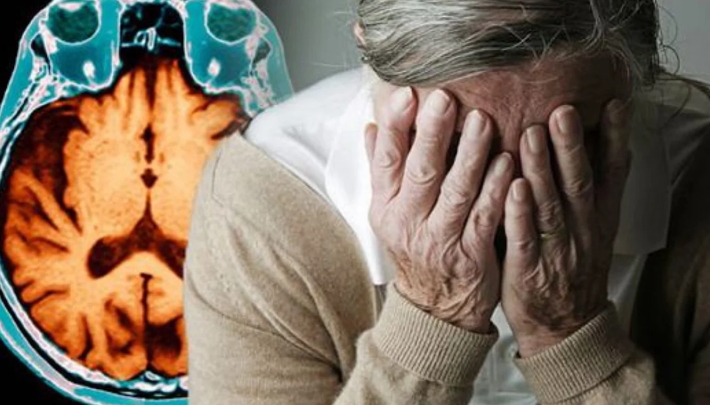 EVOO: Extra virgin olive oil and Alzheimer's disease
