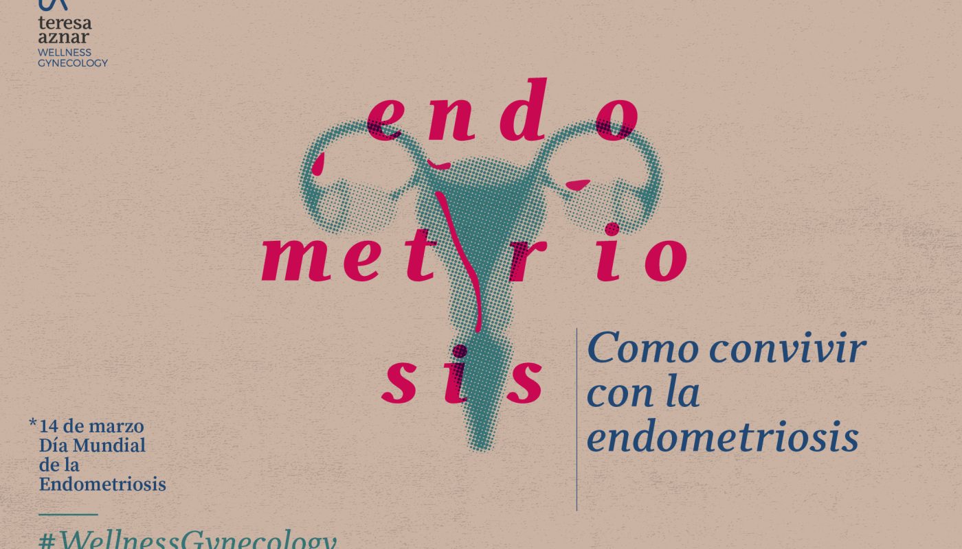 EVOO - Benefits of olive oil for endometriosis